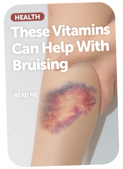 These Vitamins Can Help With Bruising